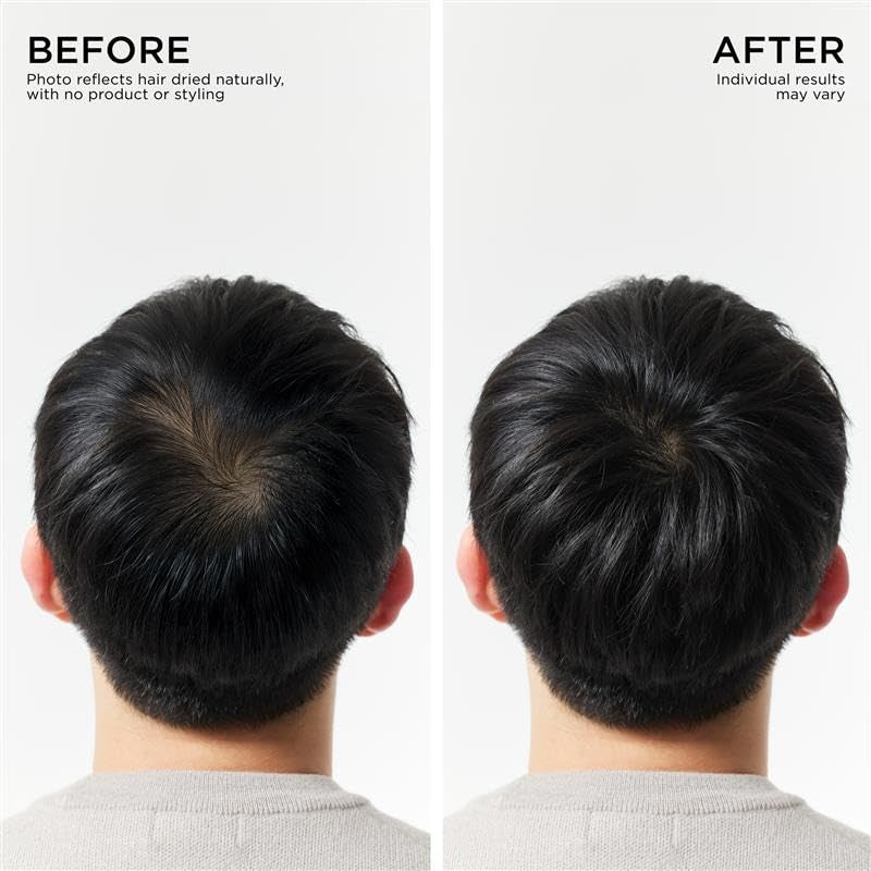 Dr. Groot Thickening Serum, Shampoo, Conditioner, and Scalp Treatment Set for Hair Loss – Clinical Results with Biotin and Rosemary for Hair Thinning, Shedding, Scalp Repair and Treatment